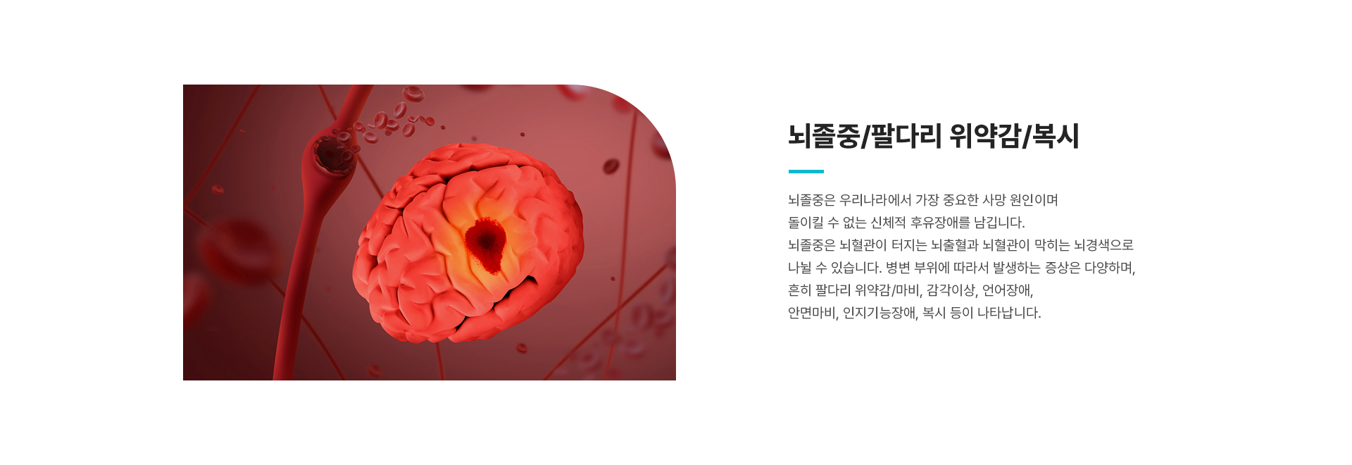 뇌졸중 상세01
