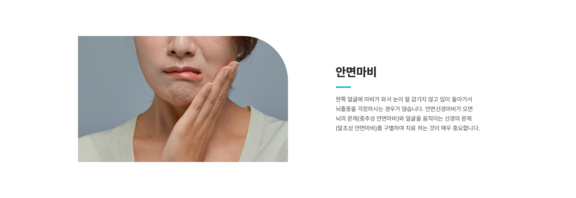 안면마비 상세01