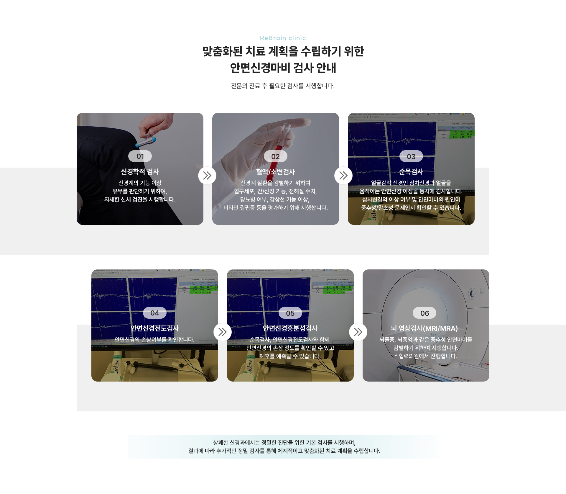안면마비 상세04